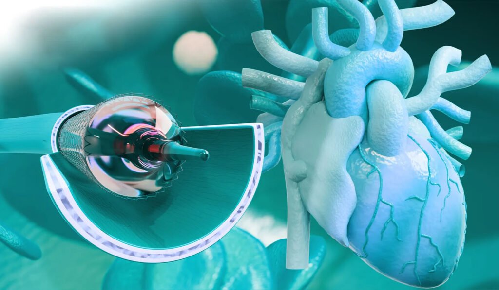 What Is EECP Treatment? A Non Surgical Treatment for Angina Relief and Heart Failure